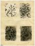Primary view of [Four Photographs of E. J.'s Sickle-Cell Anemia from Six Hours to Forty-Eight Hours]